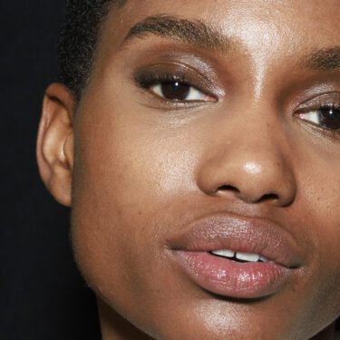 laser treatments for dark skin tones