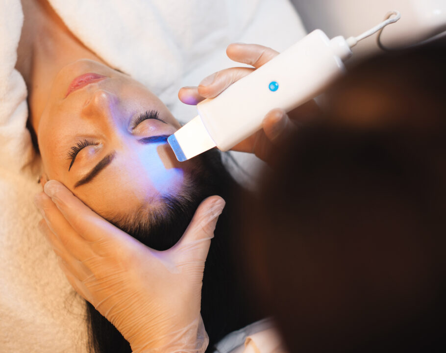 moxi laser