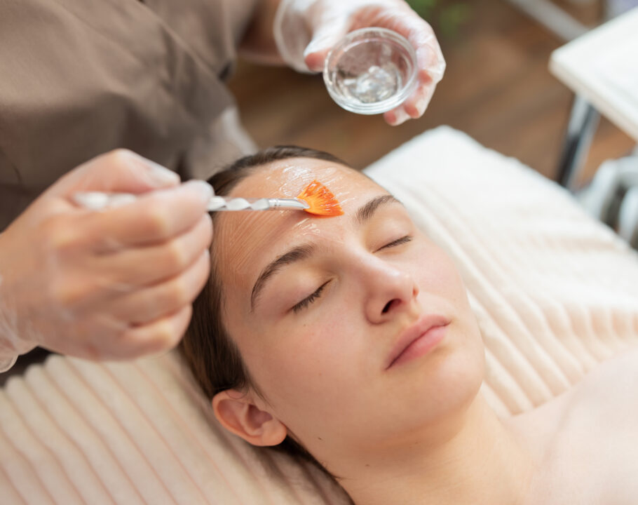 phenol peel
