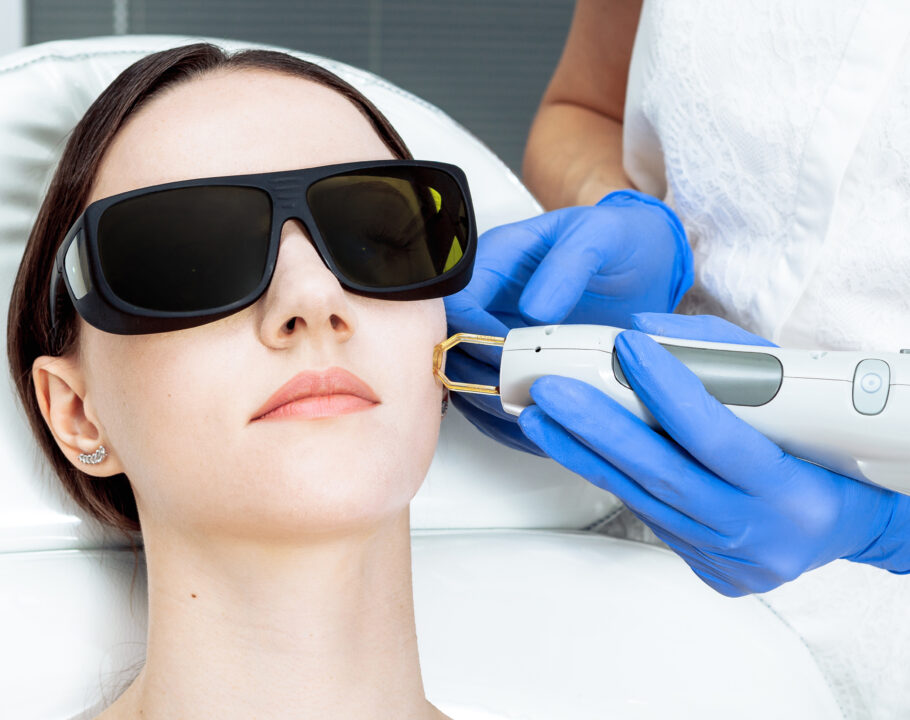 laser skin treatment