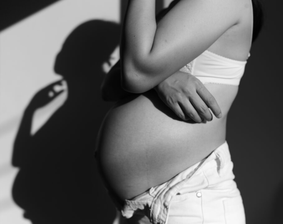 pregnancy stretch marks